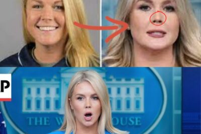 “We’re Watching a Nose Job in Real Time!” Karoline Leavitt Mocked After Bizarre Press Briefing Appearance