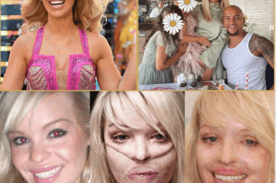 “Hard But Worth It” — Katie Piper Gets Candid About Love After Surviving an Acid Attack!