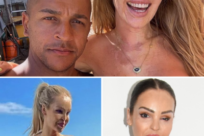 250 Surgeries And Untold Scars: The Horrifying Truth Behind Katie Piper’s Viral Bikini Body!