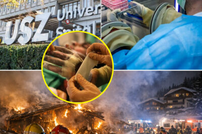 “The Critical Phase Isn’t Over”: Doctors Reveal Alarming Reality Weeks After the Crans-Montana Wildfire