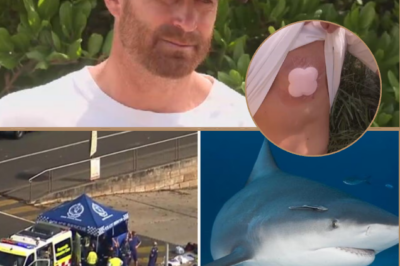 “I THOUGHT I WAS GOING TO D:I-E..!” — SHARK SURVIVOR RECOUNTS THE TERRIFYING MOMENT OF THE ATTACK ON NSW MID NORTH COAST!