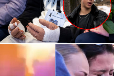 “Mom, it hurts so much”: The heart-wrenching cries at the hospital from the Swiss fire victims as they fight for their lives through the agonizing burns!