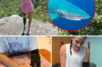 “Left hand mangled, part of the right leg torn off, and an entire sea stained red”: An update on the shark att@ck victim after 600 days of fighting — no miracle has occurred