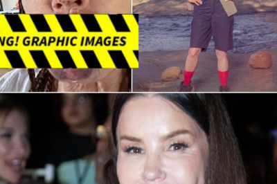 “OUCH — THIS LOOKS PAINFUL” Janice Dickinson has revealed shocking injury photos after a nasty fall on I’m A Celebrity — and fans are wincing at the images