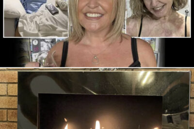 “I Was Just Lighting the Fireplace” — Woman Shares How a Split-Second Accident Changed Her Life Forever