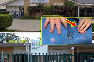 Outrage Erupts After 10-Month-Old Baby’s Fing3r Al-legedly S3vered at Queensland Chi-ldcare Centre as Disturbing Photos Surface