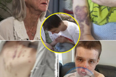 “No One Came to Help Me” — Dis-abled Man’s Sh0cking In-juries Raise Serious Questions Over NDIS Care