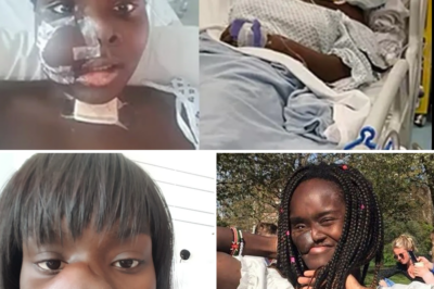 From Hannah Montana fan to resilient star: The actress who lost part of her face to bone cancer is determined to conquer the stage!