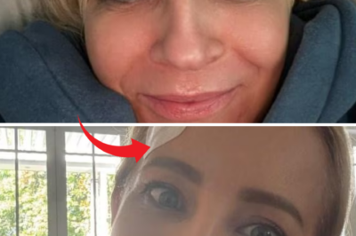 SHOCKING: Carrie Bickmore reveals horrific home accident leaving her with a deep gash and requiring emergency surgery!