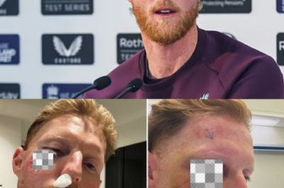 A few inches more and Ben Stokes might not be in this world: England’s Cricket captain reveals the mess he had to go through