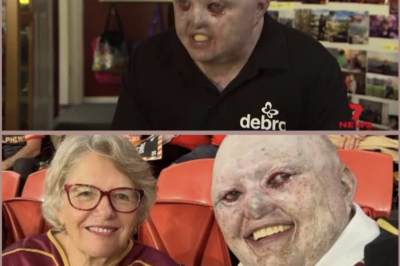 “PEOPLE WERE SAYING I SHOULD BE D-E:A-D…” — FOOTY FAN WITH RARE SKIN CONDITION SPEAKS OUT AFTER AI COMMENTS SPARK OUTRAGE!