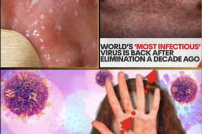 EVERYBODY NEEDS TO BE AWARE..! — HEALTH AUTHORITIES FEAR WORLD’S MOST INFECTIOUS VIRUS MAY BE SPREADING UNDETECTED!