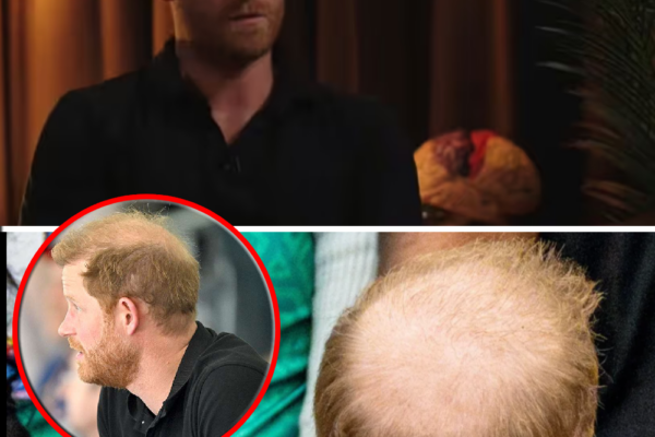 PRINCE HARRY’S SHOCKING HAIR LOSS ADMISSION — But One Unexpected Detai...